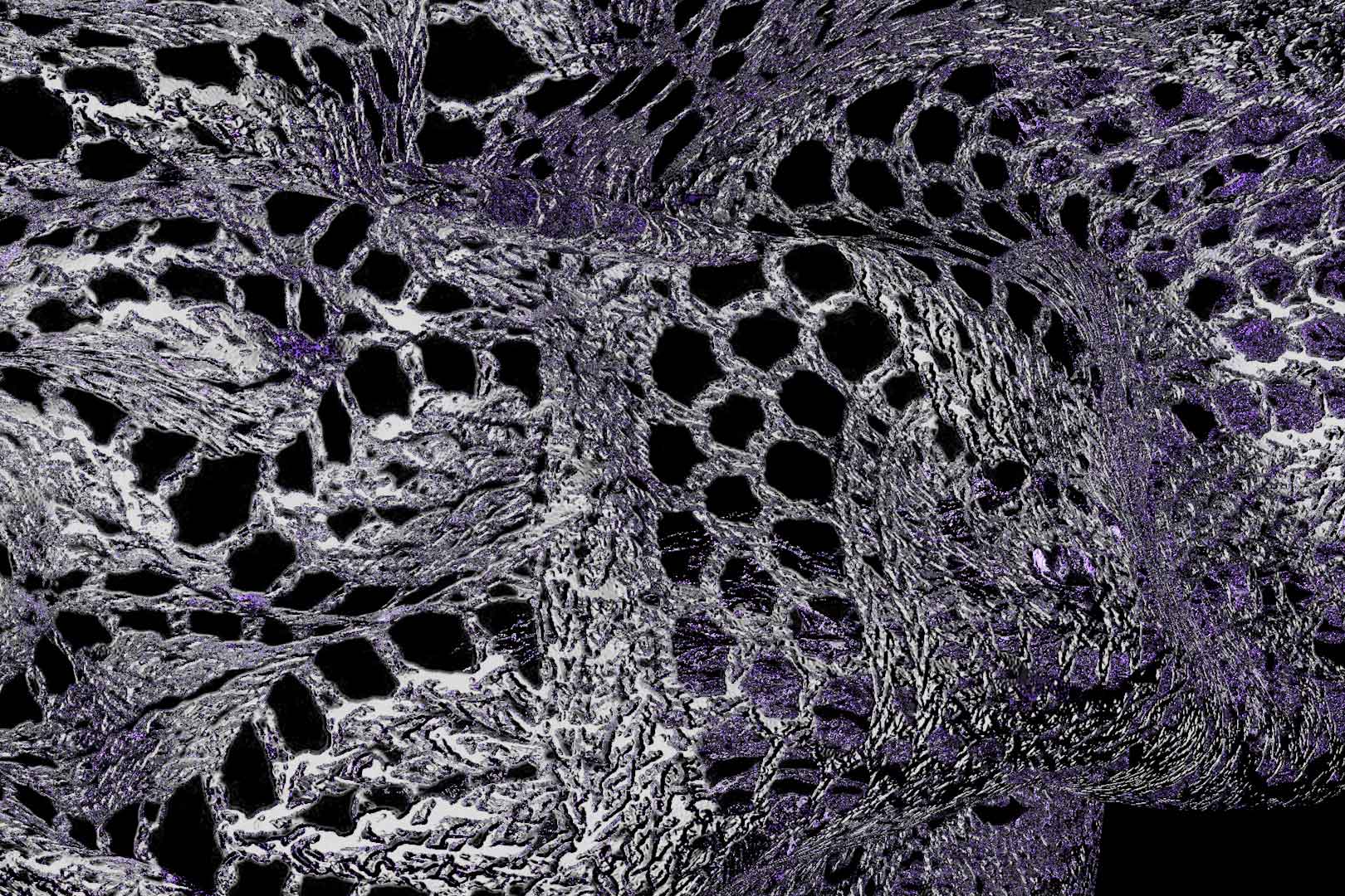 gros plan sur un napperon à la tête de hibou